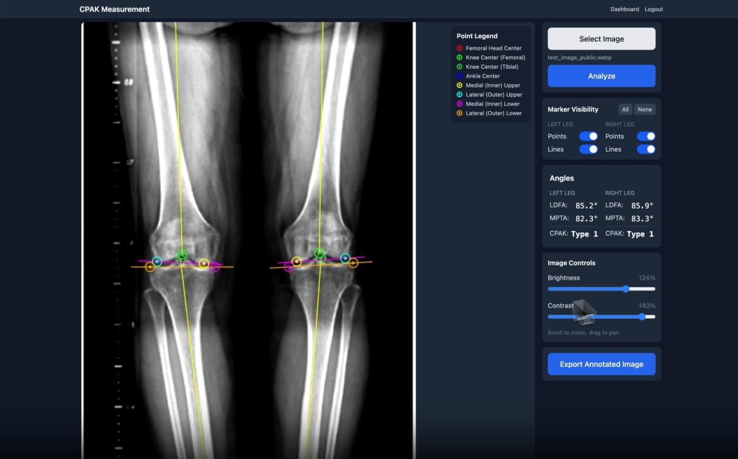 x ray of knees and alignment